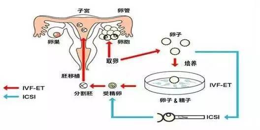 惠州试管婴儿